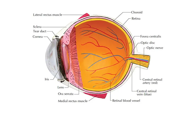 A comparison image of a clear vision and a vision blurred by cataracts.